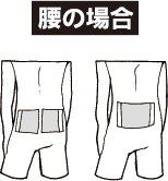 腰の場合